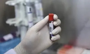 Mỡ máu cao ở tuổi đôi mươi Mỡ máu cao ở tuổi đôi mươi