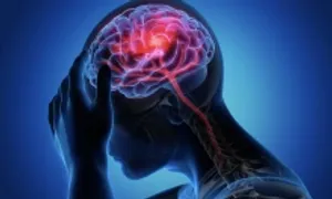 Đột quỵ và đột tử tim khác nhau thế nào? Đột quỵ và đột tử tim khác nhau thế nào?