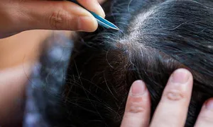 Vì sao mới 20 tuổi tóc đã bạc? Vì sao mới 20 tuổi tóc đã bạc?
